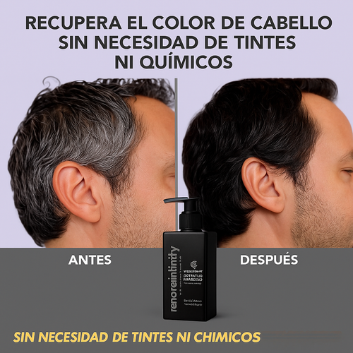 Champú Antiedad y Anticanas