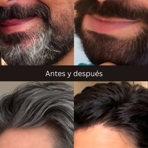 Champú Antiedad y Anticanas